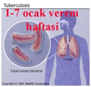 Tunceli Sağlık Müdürlüğünden Verem Haftası Açıklaması