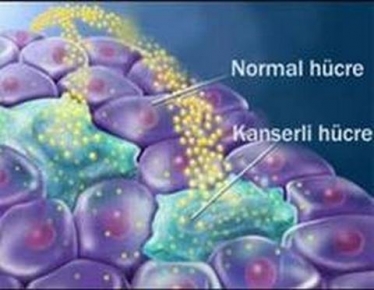 Tunceli Sağlık Müdürlüğünden Kanser Uyarısı