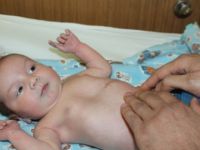 Doğduktan 8 Saat Sonra Girdiği Ameliyatla Hayata Tutundu