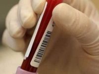 Tunceli’de HIV Virüsü Paniği