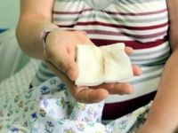 Safra kesesinden kürdan çıktı!